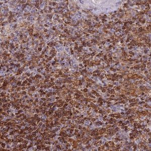 Anti-LYPD6B antibody produced in rabbit 