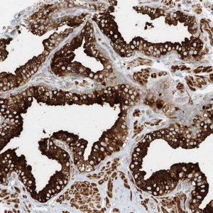 Anti-LYRM9 antibody produced in rabbit 