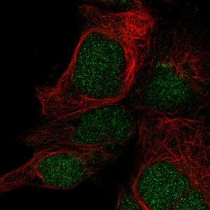 Anti-LYSMD1 antibody produced in rabbit 