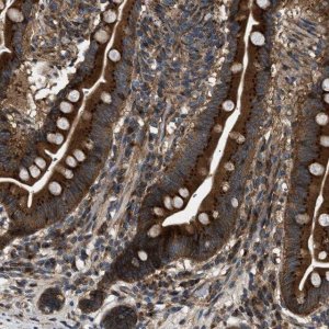 Anti-LYSMD3 antibody produced in rabbit 