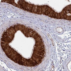 Anti-LYSMD4 antibody produced in rabbit 