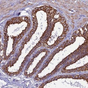 Anti-LZTS2 antibody produced in rabbit 
