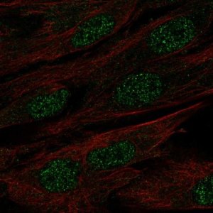 Anti-MAB21L1 antibody produced in rabbit 