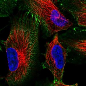 Anti-MACF1 antibody produced in rabbit 