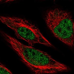 Anti-MACROD1 antibody produced in rabbit 