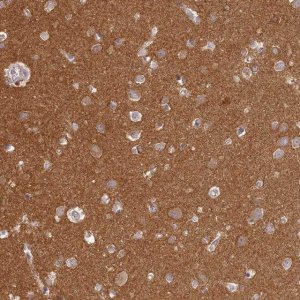 Anti-MADD antibody produced in rabbit 