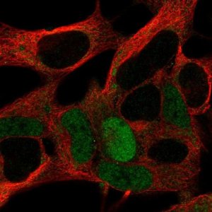 Anti-MAGEA10 antibody produced in rabbit 
