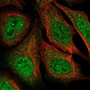 Anti-MAGEA11 antibody produced in rabbit 