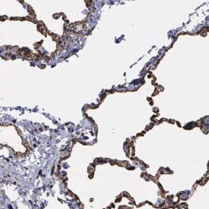 Anti-MAGEB10 antibody produced in rabbit 