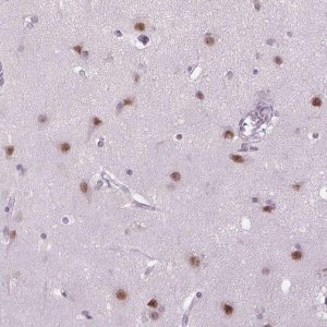 Anti-MAGEB3 antibody produced in rabbit 