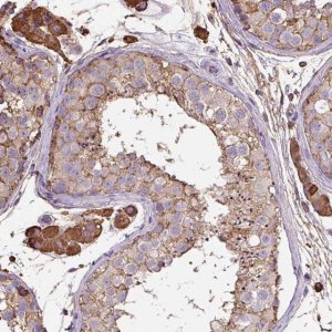 Anti-MAGEB5 antibody produced in rabbit 