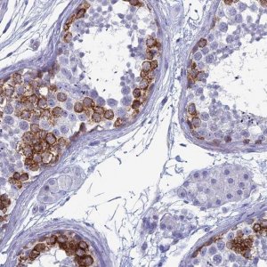 Anti-MAGEB6 antibody produced in rabbit 