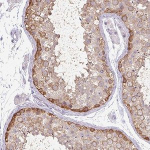 Anti-MAGEC3 antibody produced in rabbit 