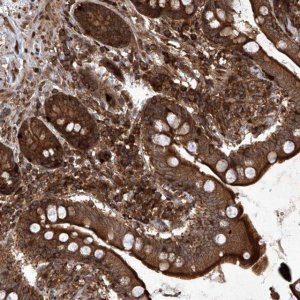 Anti-MAGED2 antibody produced in rabbit 