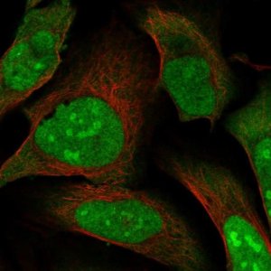 Anti-MAGED2 antibody produced in rabbit 
