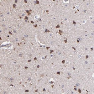 Anti-MAGEE1 antibody produced in rabbit 