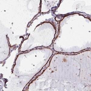 Anti-MAGT1 antibody produced in rabbit 