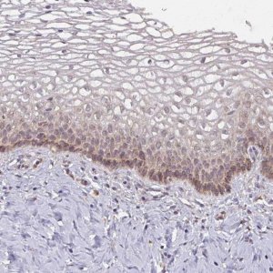 Anti-MAGT1 antibody produced in rabbit 