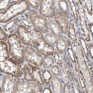 Anti-MALSU1 antibody produced in rabbit 