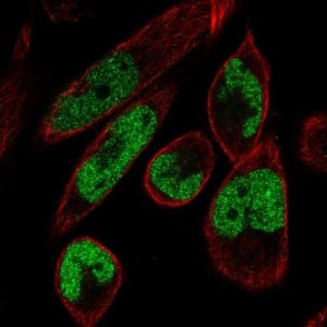 Anti-MAMLD1 antibody produced in rabbit 