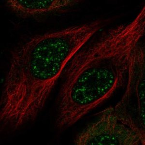 Anti-MAMSTR antibody produced in rabbit 