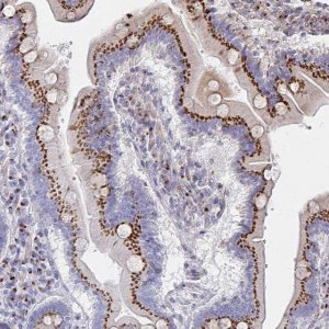 Anti-MAN1A1 antibody produced in rabbit 