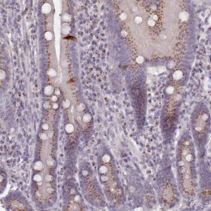 Anti-MAN1B1 antibody produced in rabbit 