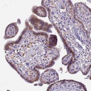 Anti-MAN1C1 antibody produced in rabbit HPA048352-100UL