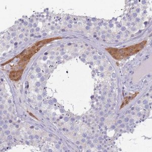 Anti-MAN1C1 antibody produced in rabbit HPA048352-100UL