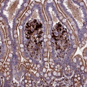 Anti-MAN2B1 antibody produced in rabbit 