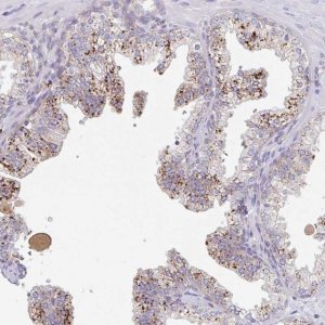 Anti-MANBA antibody produced in rabbit 