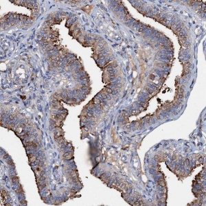 Anti-MANSC4 antibody produced in rabbit 