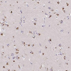 Anti-MAP1LC3A antibody produced in rabbit 