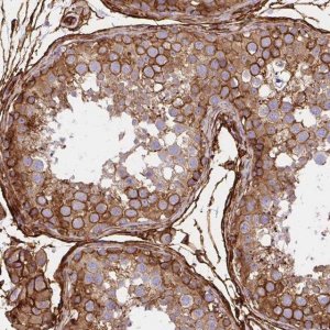 Anti-MAP1LC3B antibody produced in rabbit 