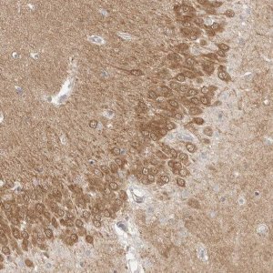 Anti-MAP2K1 antibody produced in rabbit 