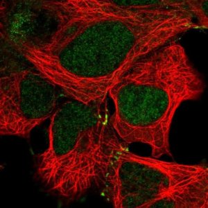 Anti-MAP2K4 antibody produced in rabbit 