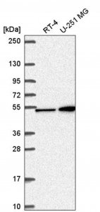 Anti-MAP2K4 antibody produced in rabbit 