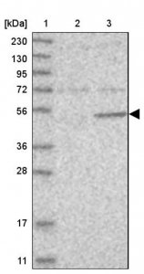 Anti-MAP2K5 antibody produced in rabbit 