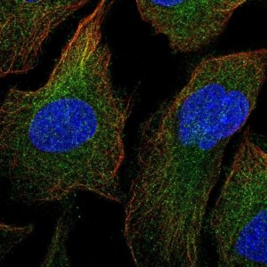 Anti-MAP3K1 antibody produced in rabbit 