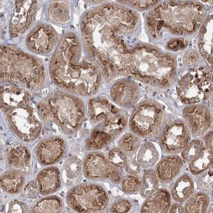 Anti-MAP3K13 antibody produced in rabbit 