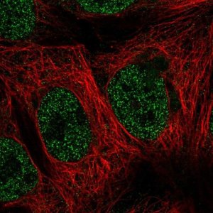 Anti-MAP3K7CL antibody produced in rabbit 