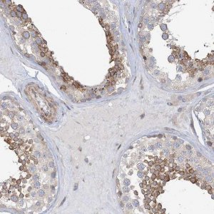 Anti-MAP4K5 antibody produced in rabbit 