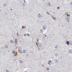 Anti-MAP6D1 antibody produced in rabbit 