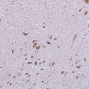 Anti-MAP7D2 antibody produced in rabbit 