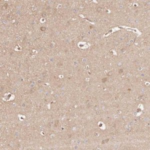 Anti-MAPK1 antibody produced in rabbit HPA030069-100UL