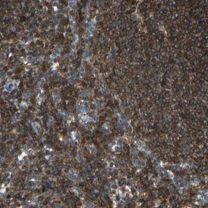 Anti-MAPK13 antibody produced in rabbit 