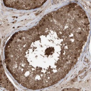 Anti-MAPK1IP1L antibody produced in rabbit 