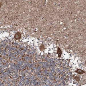 Anti-MAPK8IP2 antibody produced in rabbit 
