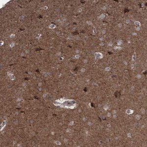 Anti-MAPK8IP2 antibody produced in rabbit 