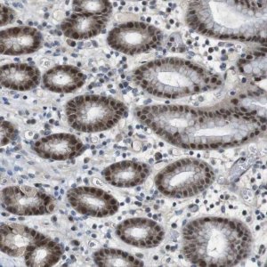 Anti-MAPKAPK5 antibody produced in rabbit 